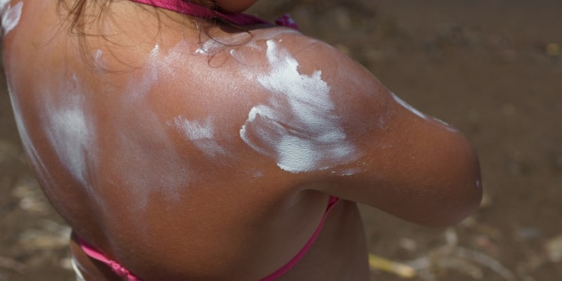 Kem chống nắng bị vón cục trên da là như thế nào?