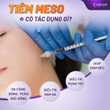 Tiêm Meso giá bao nhiêu? Bảng giá tiêm Mesotherapy 2024