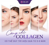 Căng chỉ collagen giữ được bao lâu? Những lưu ý cần nhớ