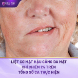 Căng da mặt có nguy hiểm không? Những lưu ý cần nhớ