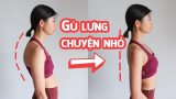 Lưng gù mặc gì? Tips chọn đồ cho nữ lưng gù ngực lép che khuyết điểm