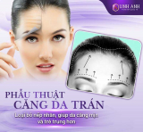 Căng da trán bằng phẫu thuật và những điều cần biết