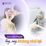 Phun lông mày bị to quá phải làm sao? Cách khắc phục hiệu quả