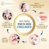 Phun môi collagen có sưng không? Có hại gì không?