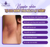 10 cách trị thâm nách sau sinh hiệu quả nhanh chóng