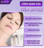 Tiêm botox gọn hàm bao lâu thì tiêm lại? [Chuyên gia giải đáp]