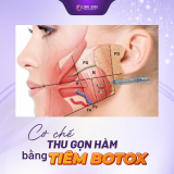 Tiêm botox bao lâu có tác dụng hiệu quả? Cách để duy trì công dụng botox lâu