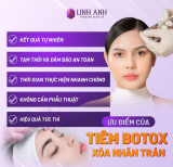 Tiêm botox nhăn trán có hiệu quả và an toàn không? Giá bao nhiêu?