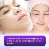 Tiêm filler bị vón cục có sao không? Nguyên nhân và cách khắc phục