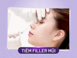 Tiêm Filler mũi duy trì được bao lâu? Có nguy hiểm không?