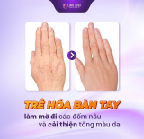 Bí kíp trẻ hóa bàn tay hiệu quả nhanh chóng