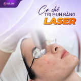 Trị mụn bằng laser bao nhiêu tiền? Bảng giá trị thâm mụn bằng laser 2024