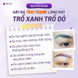 Vì sao lông mày trổ xanh trổ đỏ? Nguyên nhân? Cách xử lý hiệu quả